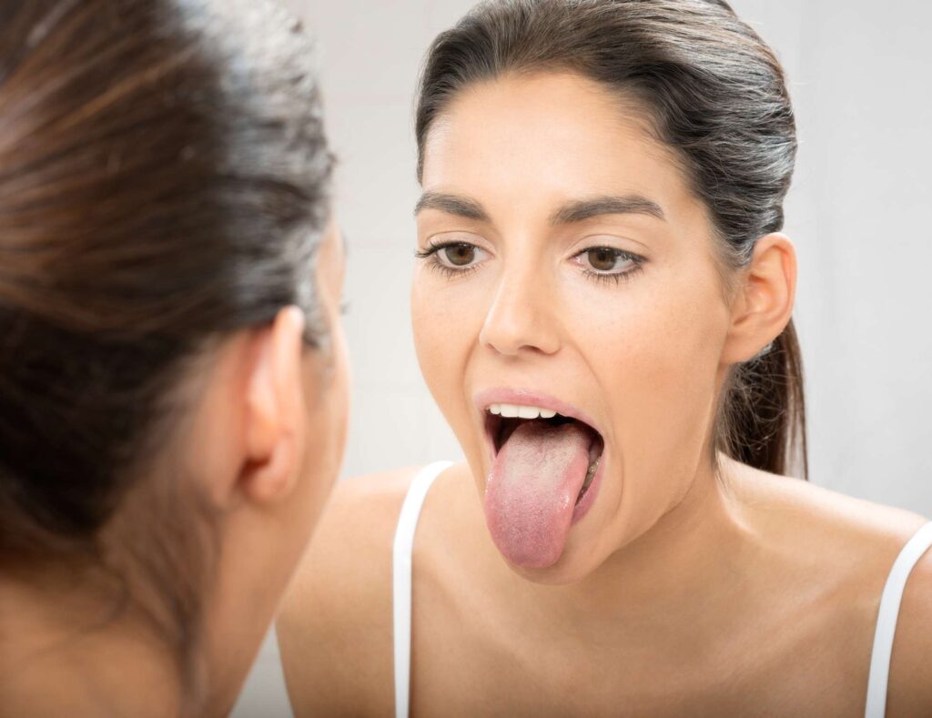 Adderall Tongue: Causes, Prevention, Treatment Adderall Tongue: Causes, Prevention, Treatment