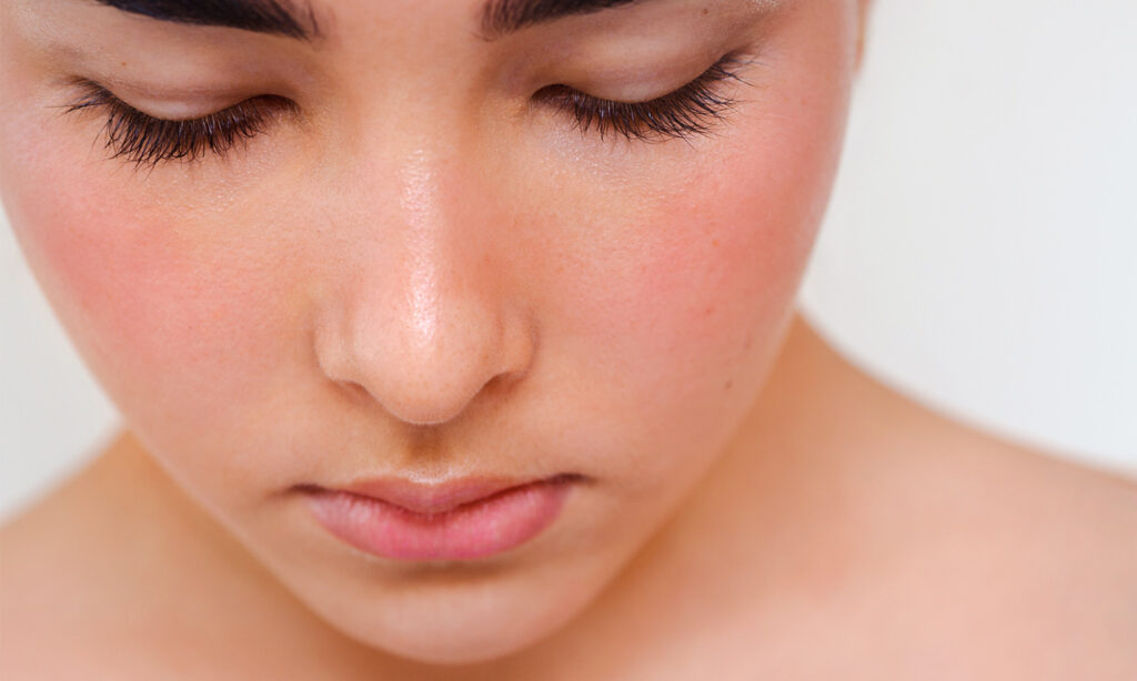 The Link Between Gut Health & Rosacea, From An Integrative Derm