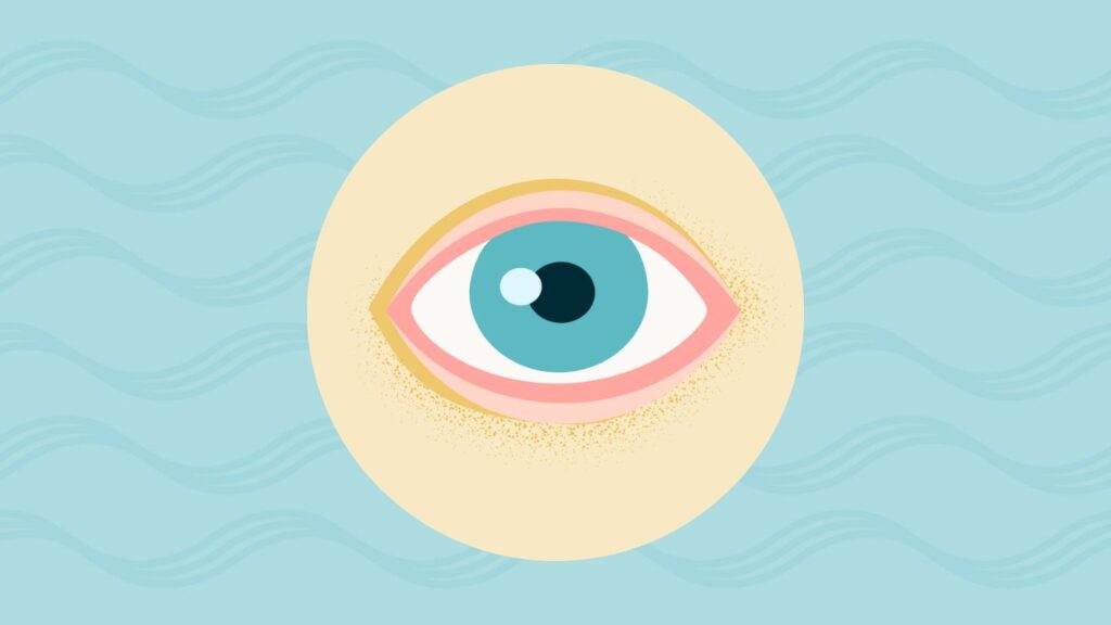 What Are ‘Bipolar Eyes’?