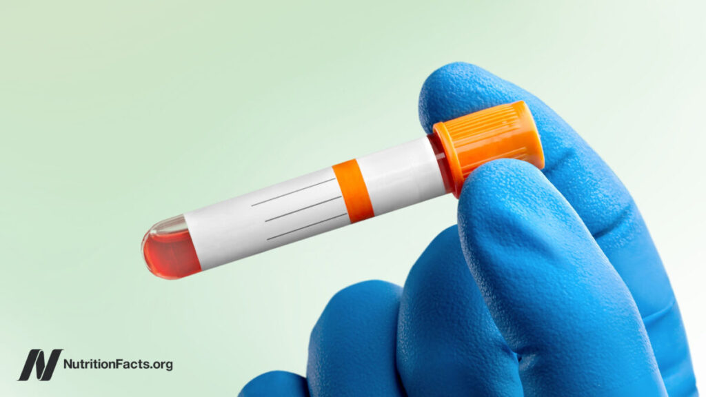 Ideal vs. Normal Cholesterol Levels Ideal vs. Normal Cholesterol Levels