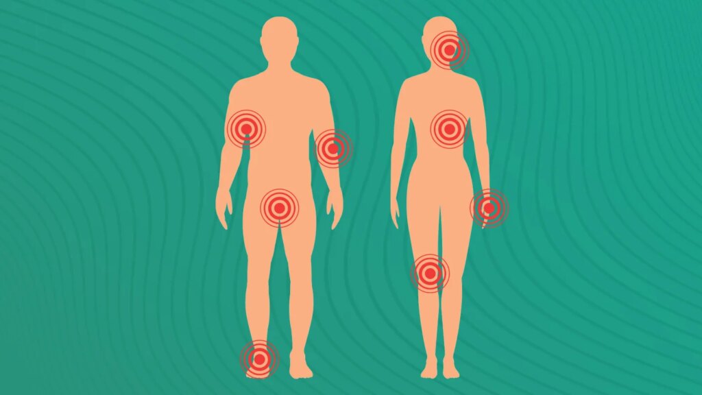 Psoriasis Flares in Sensitive Areas