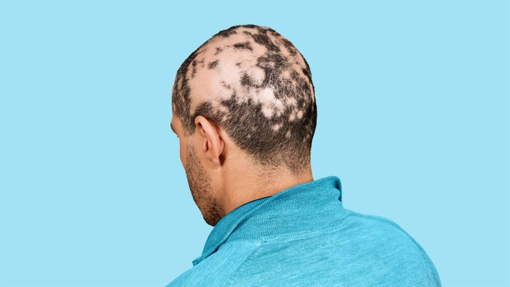 Coping With Anxiety and Depression