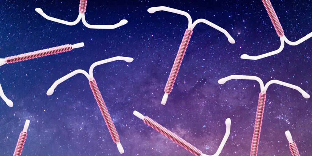 I Got Sedated for IUD Insertion Pain—Here’s What It’s Like