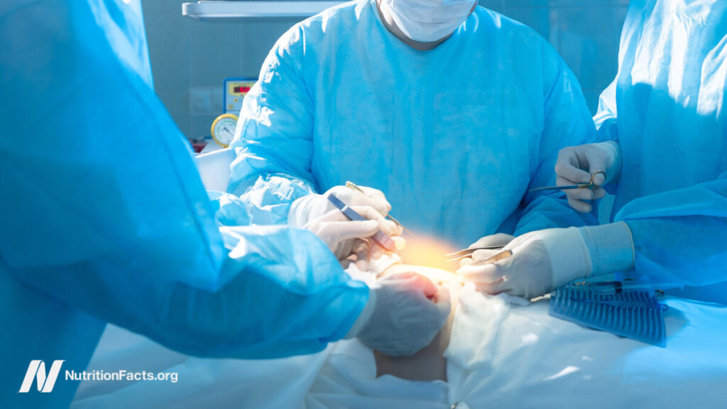 Bariatric Weight-Loss Surgery and Mortality