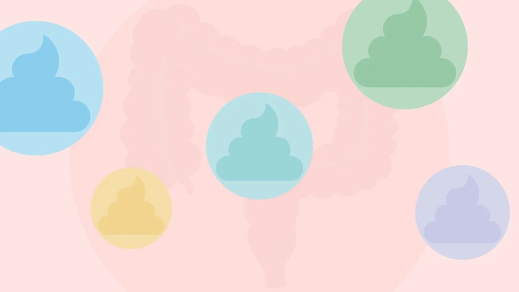 Stool Changes That Might Signal Colon Cancer Stool Changes That Might Signal Colon Cancer