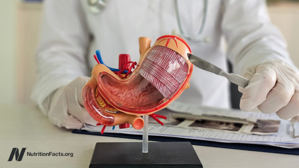 The Hidden Costs of Bariatric Surgery