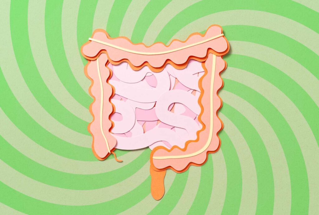 4 Supplements to Avoid If You Have Ulcerative Colitis 4 Supplements to Avoid If You Have Ulcerative Colitis