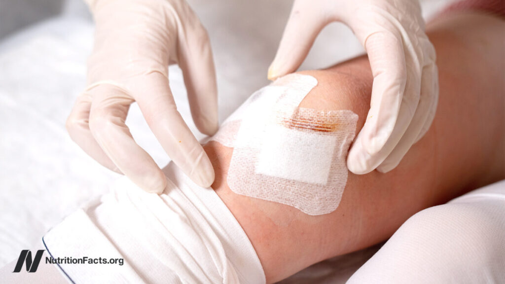 When the Fix Is an Illusion